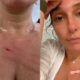 Esposa de William Bonner fica ferida após assalto no Rio