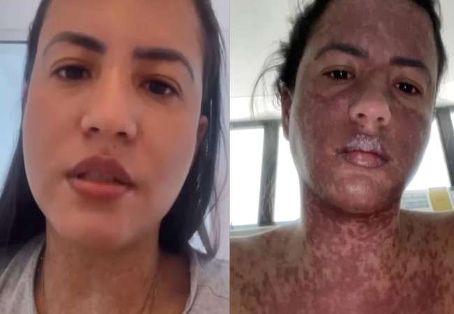 Esposa de Frank Aguiar relata "milagre" após internação na UTI