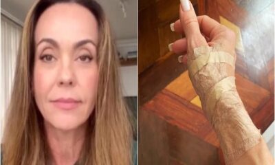 Atriz Flávia Monteiro revelou que está com tendinite e dificuldade para movimentar os dedos