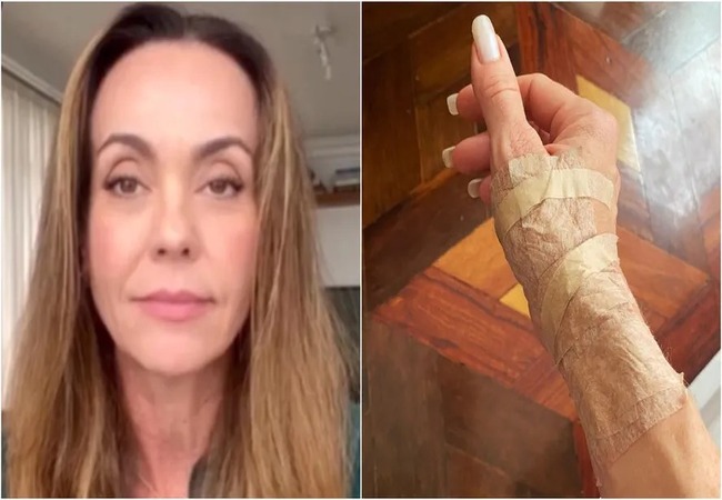 Atriz Flávia Monteiro revelou que está com tendinite e dificuldade para movimentar os dedos