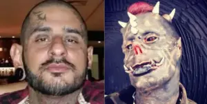 Brasileiro amputa dois dedos da mão para “ficar parecido com o Diabo”