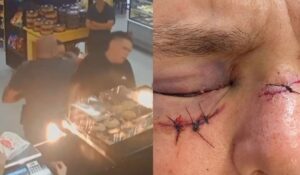 Policial dá cotovelada na cara de homem em padaria por achar que “furava fila”