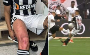 Atlético pede VAR após divulgar foto do joelho de Zaracho