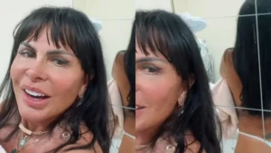 Gretchen mostra os resultados após fazer procedimento no bumbum