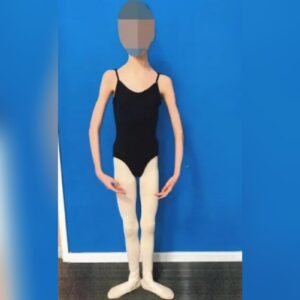 Bailarina australiana pesava apenas 27 kg com 17 anos de idade