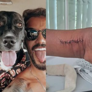 Montagem com André Coelho e cachorro de um lado; e machucado de pintor de outro