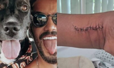 Montagem com André Coelho e cachorro de um lado; e machucado de pintor de outro