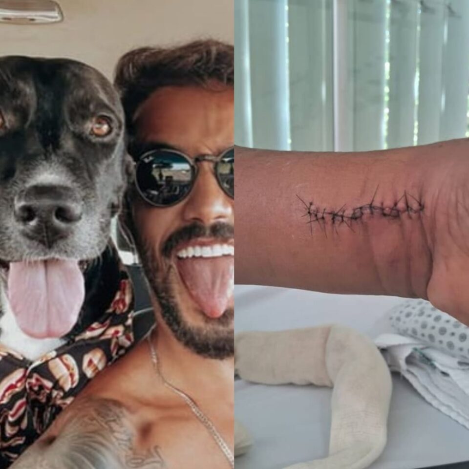 Montagem com André Coelho e cachorro de um lado; e machucado de pintor de outro