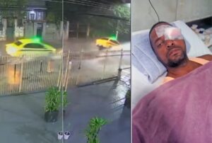 Taxista perde a visão após acidente com bueiro aberto