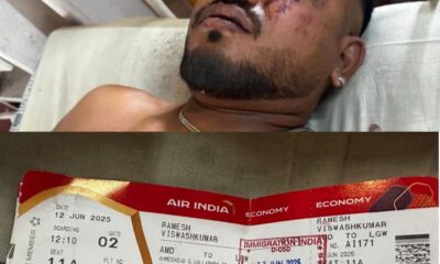 Homem com ferimentos visíveis no rosto deitado em uma maca de hospital, identificado como Ramesh Vishwash Kumar, único sobrevivente de um acidente aéreo na Índia. Abaixo, imagem mostra seu cartão de embarque da Air India com destino a Londres, indicando assento 11A