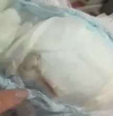 Foto mostra parte interna de uma fralda com uma área escurecida e suspeita, onde foi identificado um roedor morto, segundo relato da mãe.