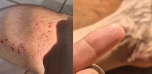 Influenciador viraliza após mordida de sucuri