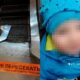 Criança de 2 anos tem braço arrancado por escada rolante em shopping