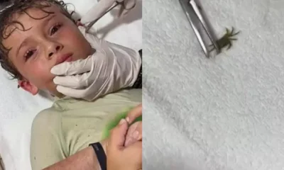 Criança deitada em uma maca sendo examinada por um médico. Ao lado, um caranguejo vivo.