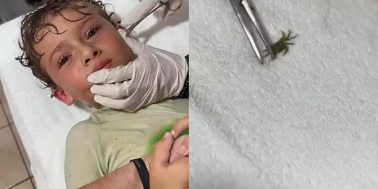 Criança deitada em uma maca sendo examinada por um médico. Ao lado, um caranguejo vivo.