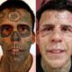 Rosto do homem mais tatuado do Brasil fica irreconhecível após remoção a laser; veja antes e depois