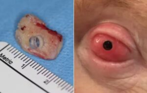 Dente vira janela para enxergar novamente