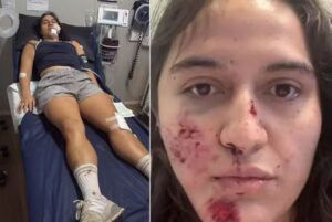 Mulher sofreu ainda uma lesão perigosa e rara em um osso localizado no pescoço | Reprodução/GoFundMe