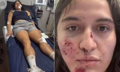 Mulher sofreu ainda uma lesão perigosa e rara em um osso localizado no pescoço | Reprodução/GoFundMe