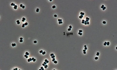 Imagem mostra bactérias.