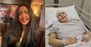 Hannah Roper, de 24 anos, precisou passar por cirurgias delicadas após queda em escada