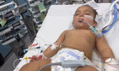 Família busca cirurgia para bebê queimado por soda cáustica