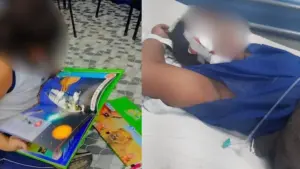 Criança fica sem visão de um olho após ataque em escola municipal