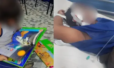 Criança fica sem visão de um olho após ataque em escola municipal