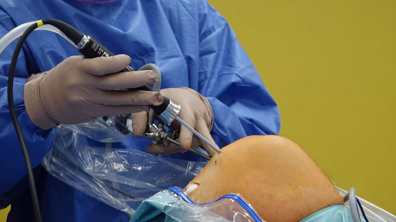 Idosa acorda após cirurgia e descobre que prótese foi implantada no joelho errado